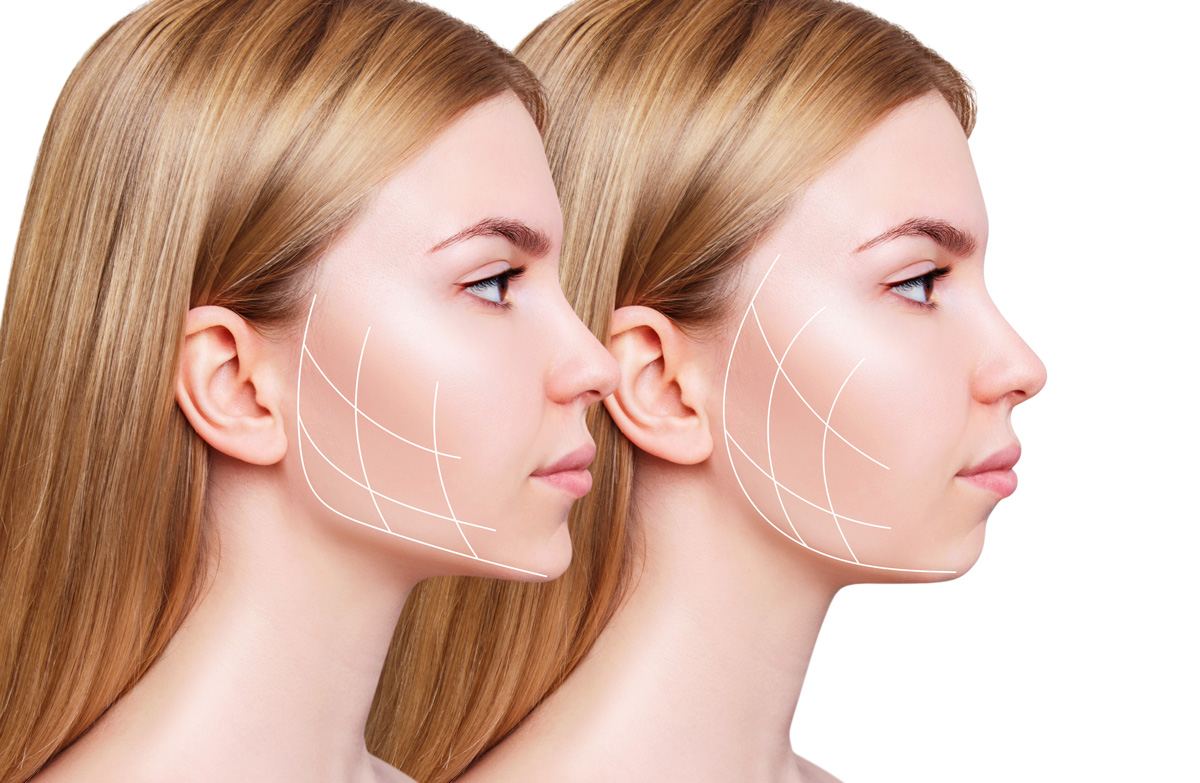 Corrective Jaw Surgery Corrective Jaw Surgery
